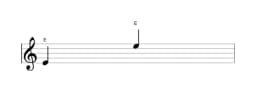 Noten der Note E in mehreren Oktaven (4)